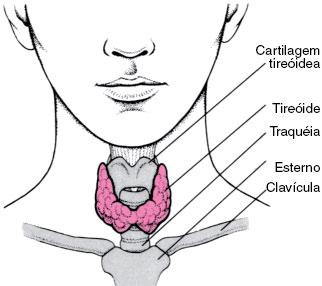 Distúrbios da Tireóide